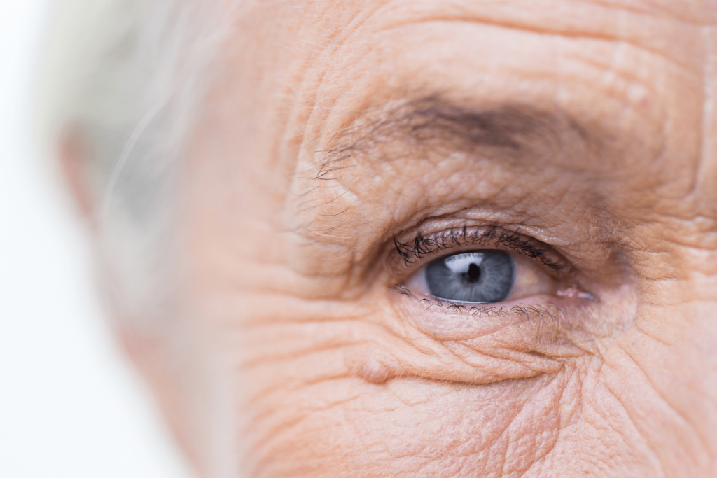 The Connection Between Dementia and Vision Loss